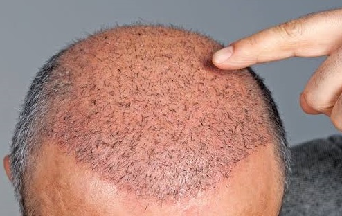 hair